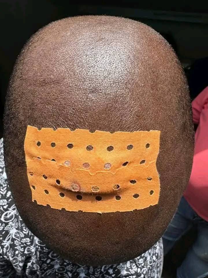 Tentative d’assaut contre la MATCA : 13 interpellations et un chef de gang blessé 3 photo blessure 3